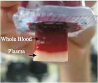 Handheld Plasma Isolation Device