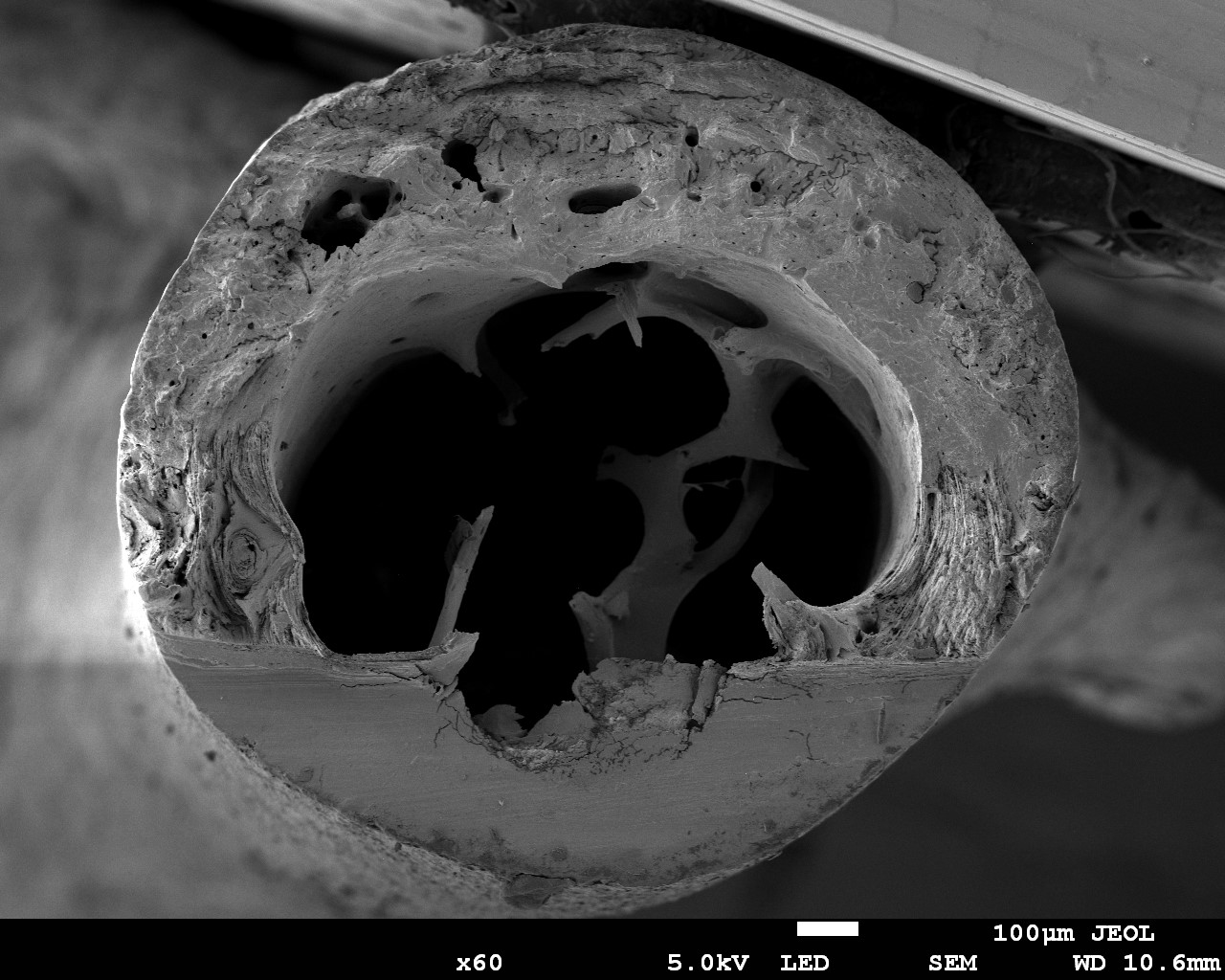 Fracture in a Mouse Bone