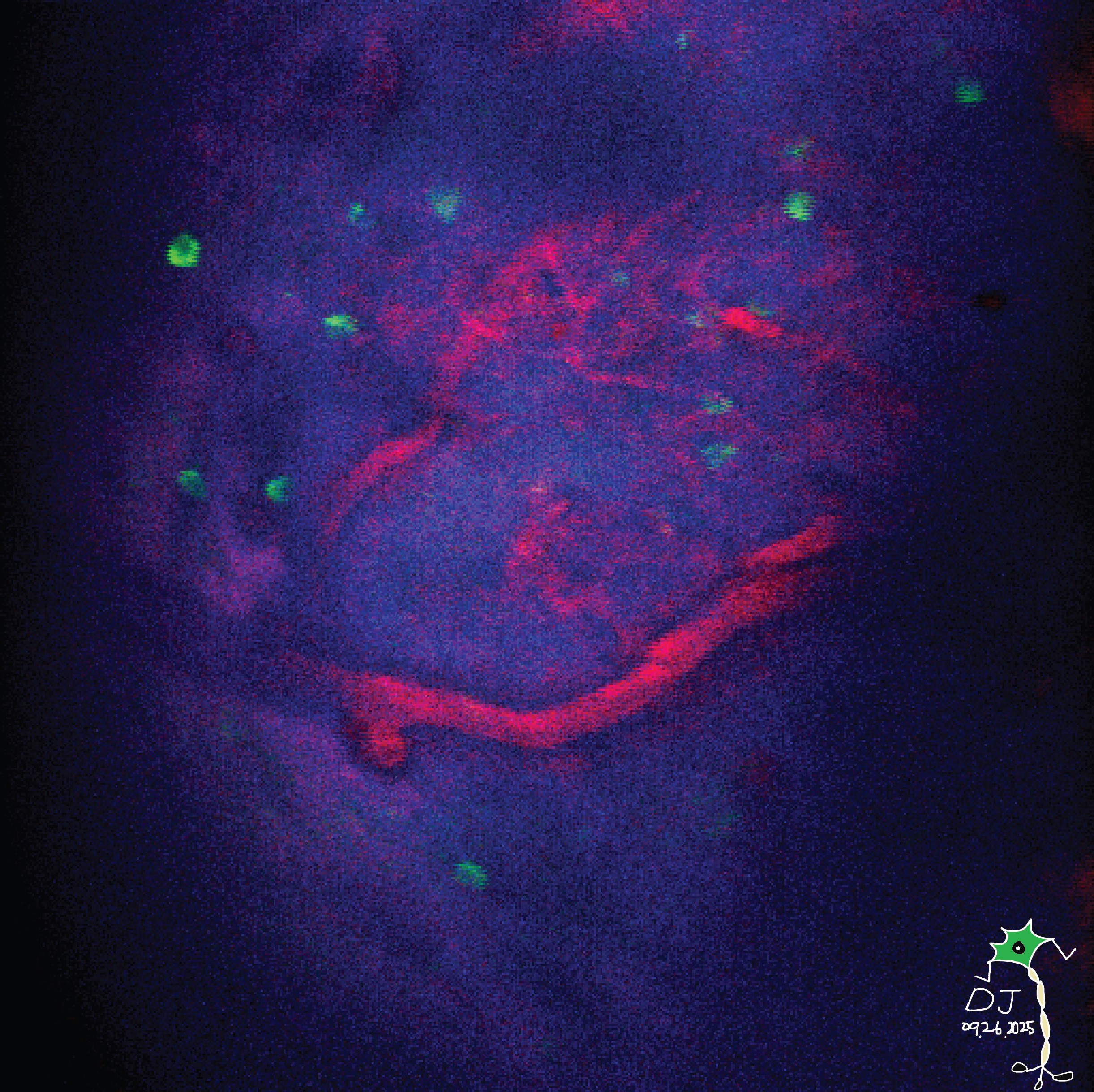 Neurons in the Vascular Jungle