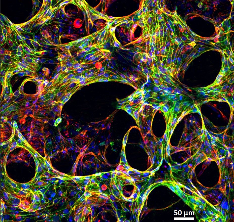 Vascular network within natural hydrogel