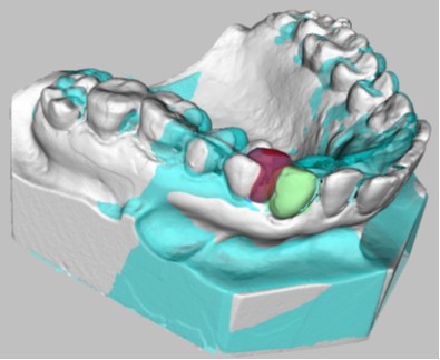 Scan images of teeth