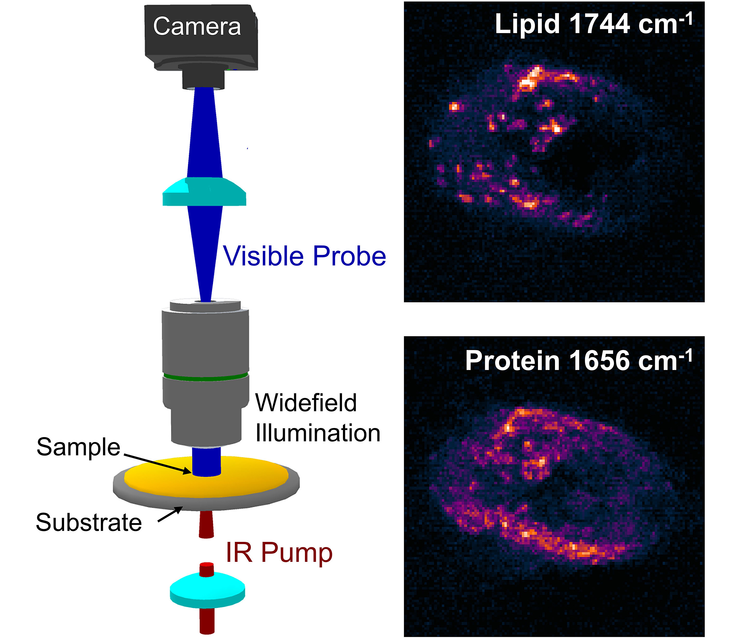 cancer imaging