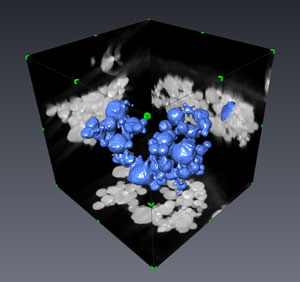 3-D electron microscopy reconstruction of aluminum nanoparticles