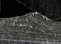 This frame from a high-speed camera sequence reveals surprising behavior in a solid piece of metal sliding over another. The research is providing new insights into the mechanisms of wear and generation of machined surfaces that could help improve the durability of metal parts.