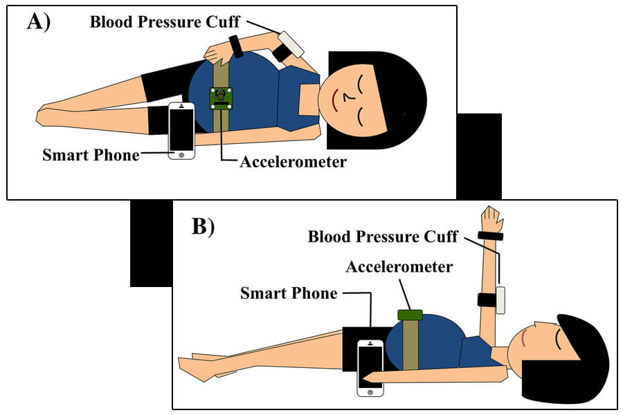 Blood pressure bracelet illustration