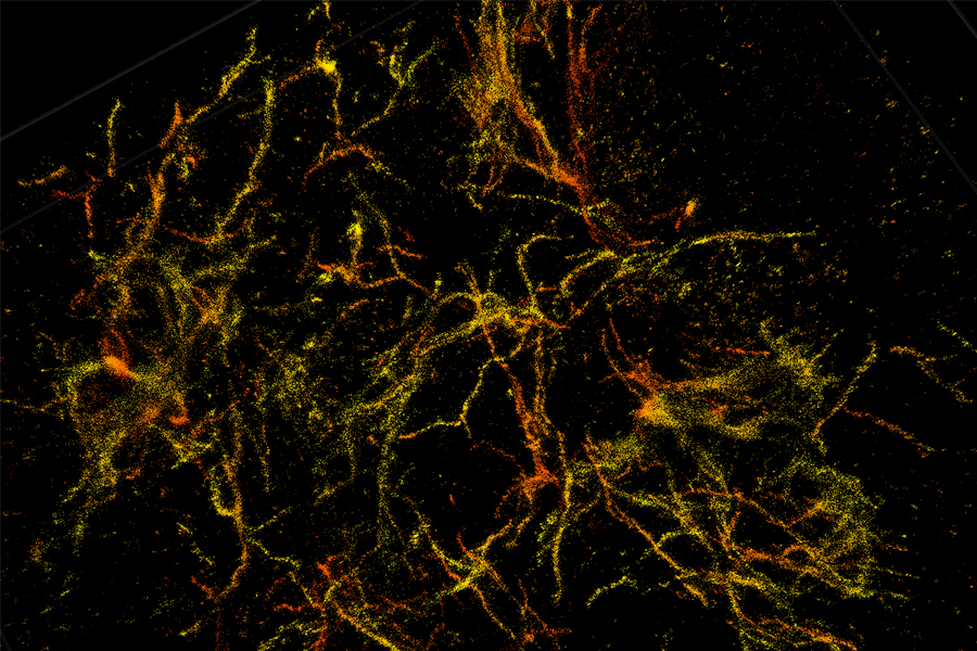 Clearer and more detailed images reveal how amyloid plaques damage the brain, leading to Alzheimer's disease.