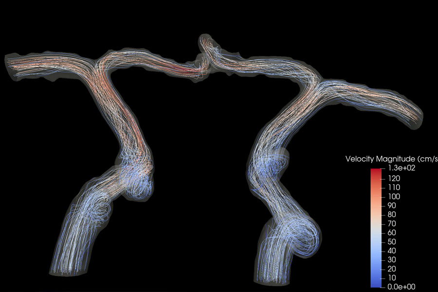 Photo of blood flow GIF