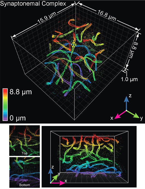 twisted synaptonemal complex