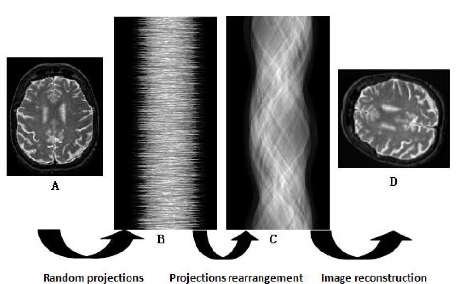 Estimating view parameters from random projections for Tomography using spherical MDS