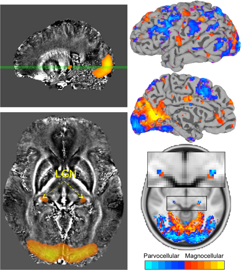 ieee research paper on brain fingerprinting
